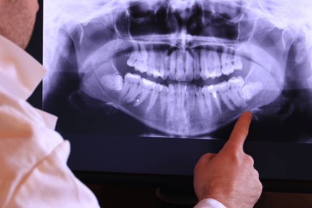 Best Emergency Gum Treatment in West Pittston, PA