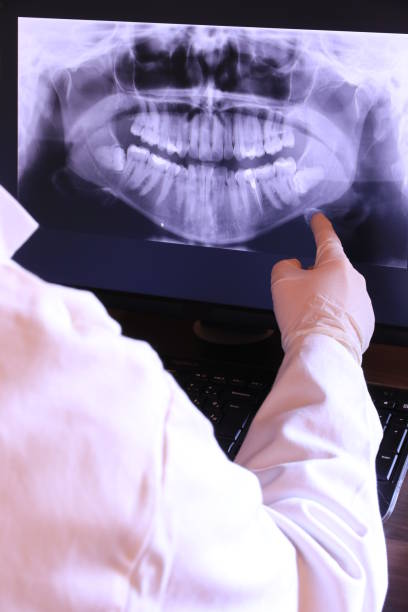 Best Emergency Dental Care for Broken or Chipped Teeth in West Pittston, PA