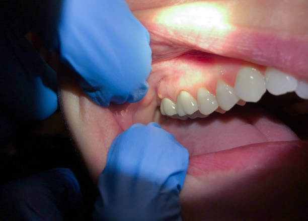 Best Cosmetic Emergency Dentistry in West Pittston, PA