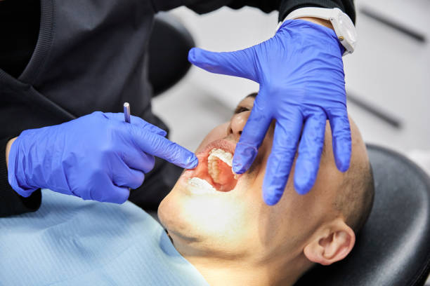 Best Emergency Treatment for Dental Infections or Abscesses in West Pittston, PA