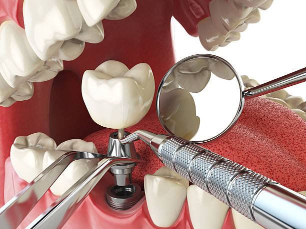 Best Emergency Denture Repair in West Pittston, PA